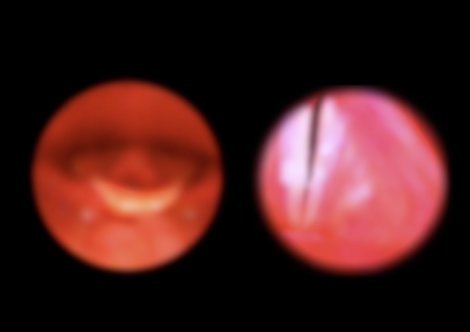 Progression of abstraction - 5